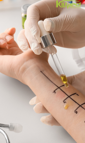 Alergista Médico alergista realizando testes alérgicos em um paciente.